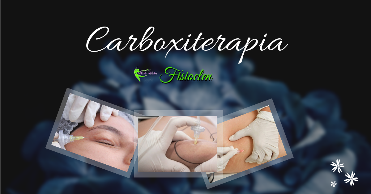 Carboxterapia